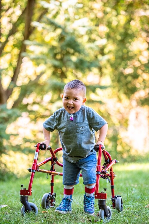Ian Faist had his first surgery at a day old. Today, he's a thriving first grader, but his family still faces challenges. (Photo courtesy of the Faist family)